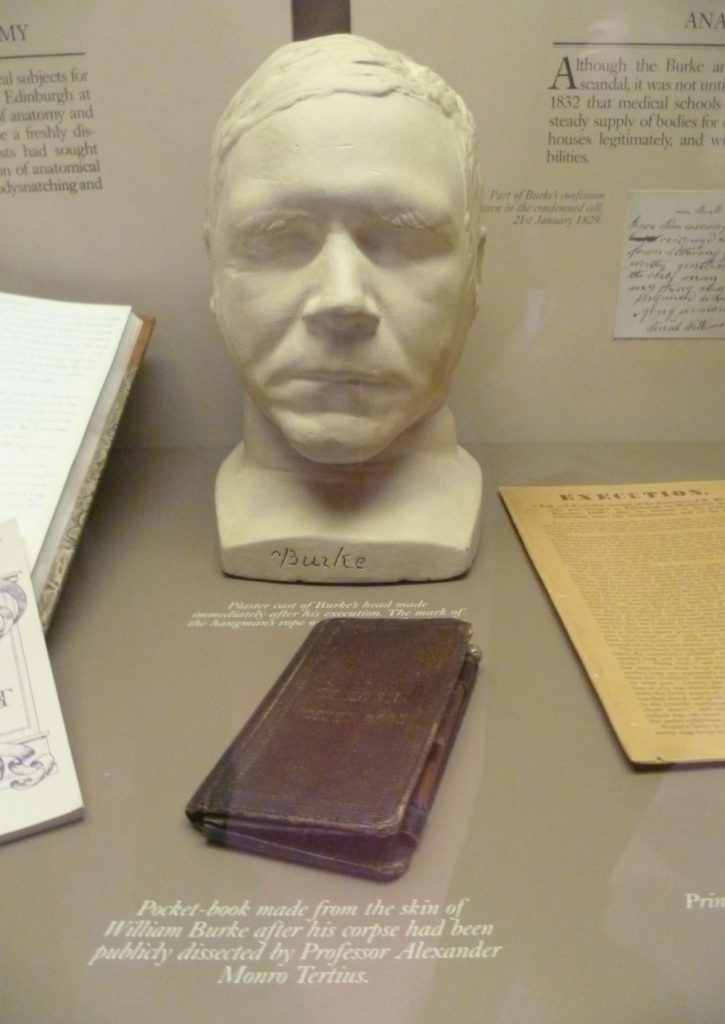 A death mask at the Surgeons’ Hall Museums is definitely an offbeat thing to see in Edinburgh.